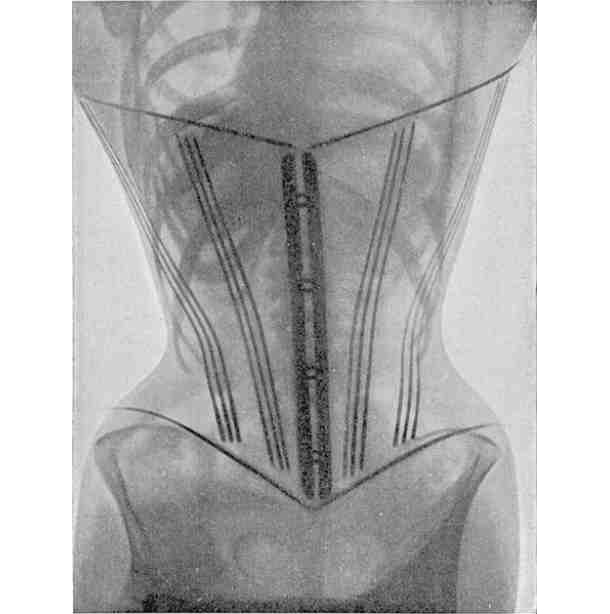 1908 corseted women 2